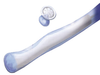 Guaine per sonde ecografiche pregellate latex free
