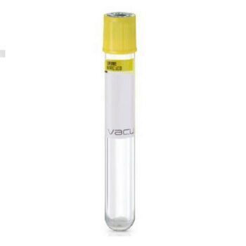 Provetta cilindrica per urina con tappo giallo, sterile.