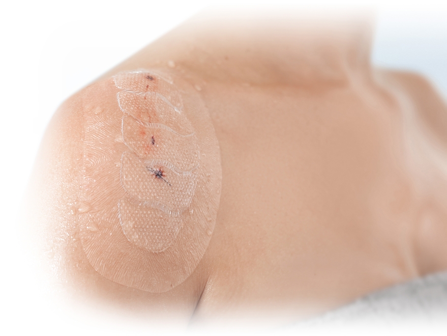 Medicazione adesiva trasparente con tampone assorbente in idrogel Leukomed control, sterile
