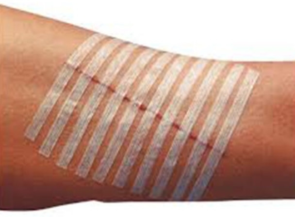 Cerotti per sutura cutanea 3M strip rinforzati, sterili