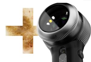 Dermlite DL5 Plus dermatoscopio a LED